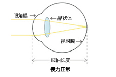 Vol.6 近視?遠視?散光?老花